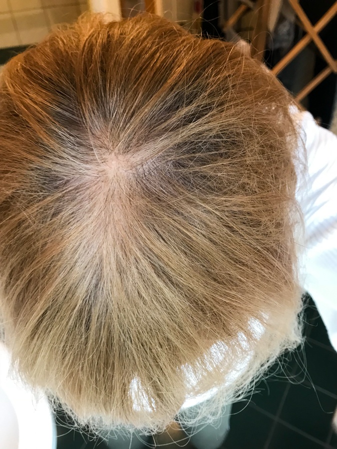 hair with outgrow