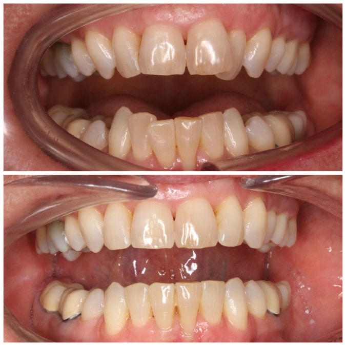 teeth