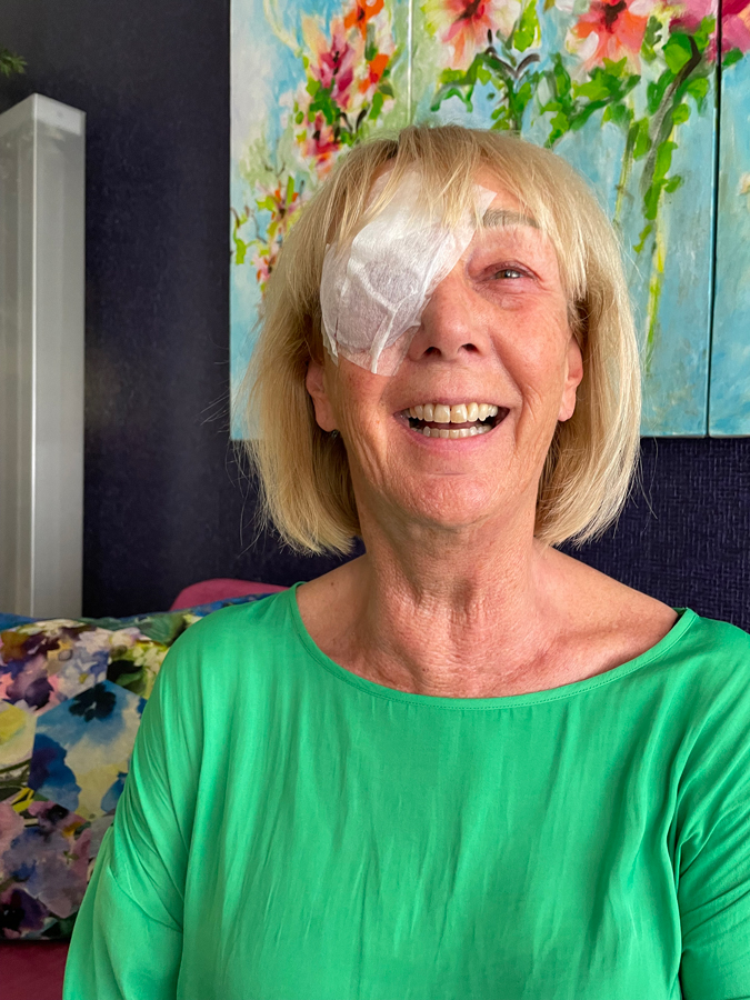 Cataract operation
